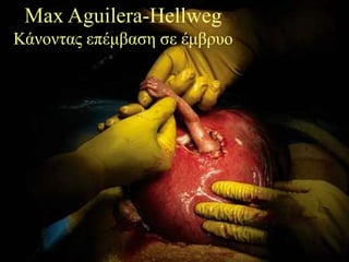 Max Aguilera-Hellweg
Κάλνληαο επέκβαζε ζε έκβξπν
 