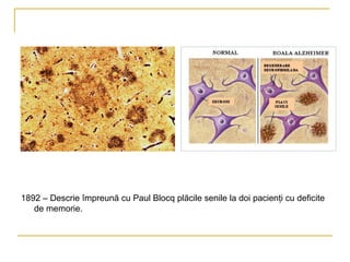 1892 – Descrie împreună cu Paul Blocq plăcile senile la doi pacienţi cu deficite de memorie. 