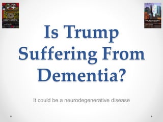 Is Trump
Suffering From
Dementia?
It could be a neurodegenerative disease
 