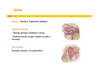 Sífilis
Agente: Bactéria Treponema pallidum
Sintomas e Sinais:
-  Úlceras genitais indolores e duras;
-  Posteriormente surgem lesões na pele e
mucosas.
Transmissão:
Contacto sexual e via placentária

 