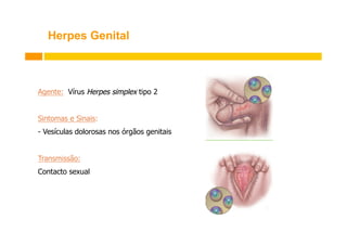 Herpes Genital

Agente: Vírus Herpes simplex tipo 2
Sintomas e Sinais:
- Vesículas dolorosas nos órgãos genitais
Transmissão:
Contacto sexual

 
