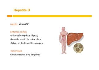 Hepatite B

Agente: Vírus HBV
Sintomas e Sinais:
- Inflamação hepática (fígado)
- Amarelecimento da pele e olhos
- Febre, perda de apetite e cansaço
Transmissão:
Contacto sexual e via sanguínea

 