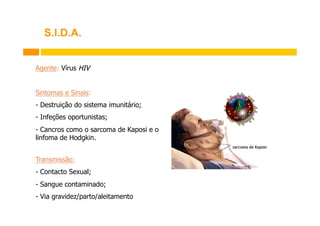 S.I.D.A.
Agente: Vírus HIV
Sintomas e Sinais:
-  Destruição do sistema imunitário;
-  Infeções oportunistas;
-  Cancros como o sarcoma de Kaposi e o
linfoma de Hodgkin.
Transmissão:
-  Contacto Sexual;
-  Sangue contaminado;
-  Via gravidez/parto/aleitamento

 
