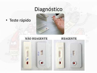Diagnóstico
• Teste rápido
 