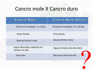 Cancro mole X Cancro duro
Tempo de incubação: 2 a 5 dias Tempo de incubação: 21 a 30 dias
Várias feridas Única ferida
Base da ferida é mole Base da ferida é dura
Íngua inflamada e dolorida em
apenas um lado
Ínguas inchadas dos dois lados
Causa dor Não causa nenhuma dor
 