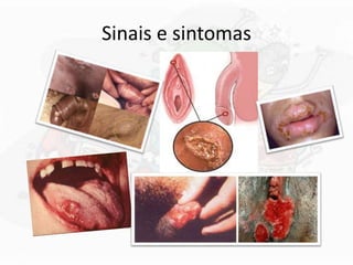 Sinais e sintomas
 