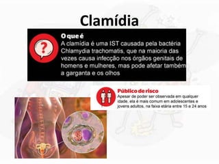 Clamídia
 