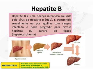 Hepatite B
Hepatite B é uma doença infecciosa causada
pelo vírus da Hepatite B (HBV). É transmitida
sexualmente ou por agulhas com sangue
infectado e pode progredir para cirrose
hepática ou cancro do fígado
(hepatocarcinoma).
 