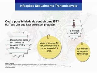 Qual a possibilidade de contrair uma IST?
R.: Toda vez que fizer sexo sem proteção.
Infecções Sexualmente Transmissíveis
Imagens ©Pixabay
O que são infecções sexualmente transmissíveis? Khan Academy. (CC BY-NC-SA 3.0 US). Disponível em:
https://pt.khanacademy.org/science/8-ano/infeccoes-sexualmente-transmissiveis/infeccao-sexualmente-transmissivel/a/what-are-sexually-
transmitted-diseases
500 milhões
de pessoas
têm herpes
Diariamente, cerca
de 1 milhão de
pessoas contrai
uma IST.
Maior chance se for
sexualmente ativo e
com menos de 25
anos.
3 milhões
têm HPV
 