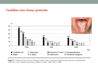 Candidíase como doença oportunista
 