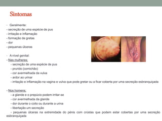 Sintomas
• Geralmente:
- secreção de uma espécie de pus
- irritação e inflamação
- formação de gretas
- dor
- pequenas úlceras

• A nível genital:
- Nas mulheres:
   - secreção de uma espécie de pus
   - prurido (comichão)
   - cor avermelhada da vulva
   - ardor ao urinar
   - irritação e inflamação na vagina e vulva que pode gretar ou a ficar coberta por uma secreção esbranquiçada

- Nos homens:
   - a glande e o prepúcio podem irritar-se
   - cor avermelhada da glande
   - dor durante o coito ou durante a urina
   - libertação um secreção
   - pequenas úlceras na extremidade do pénis com crostas que podem estar cobertas por uma secreção
esbranquiçada
 