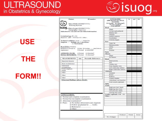 ISUOG Mid-trimester Guidelines | PPT