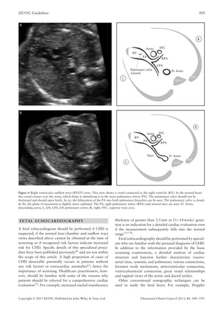 ISUOG Guidelines 355
R
RV
PA
SVC
RPA
LPA
Aorta
Pulmonary valve
(closed)
L
Spine
Rib
R
RV
PA
SVC
RPA
Duct D. Aorta
D. Aorta
Aorta
L Spine
Rib
Figure 6 Right ventricular outﬂow tract (RVOT) view. This view shows a vessel connected to the right ventricle (RV). In the normal heart
this vessel crosses over the aorta, which helps in identifying it as the main pulmonary artery (PA). The pulmonary valve should not be
thickened and should open freely. In (a), the bifurcation of the PA into both pulmonary branches can be seen. The pulmonary valve is closed.
In (b), the plane of insonation is slightly more cephalad. The PA, right pulmonary artery (RPA) and arterial duct are seen. D. Aorta,
descending aorta; L, left; LPA, left pulmonary artery; R, right; SVC, superior vena cava.
FETAL ECHOCARDIOGRAPHY
A fetal echocardiogram should be performed if CHD is
suspected, if the normal four-chamber and outﬂow tract
views described above cannot be obtained at the time of
screening or if recognized risk factors indicate increased
risk for CHD. Speciﬁc details of this specialized proce-
dure have been published previously26
and are not within
the scope of this article. A high proportion of cases of
CHD detectable prenatally occurs in patients without
any risk factors or extracardiac anomalies63
; hence the
importance of screening. Healthcare practitioners, how-
ever, should be familiar with some of the reasons why
patients should be referred for a comprehensive cardiac
evaluation74
. For example, increased nuchal translucency
thickness of greater than 3.5 mm at 11–14 weeks’ gesta-
tion is an indication for a detailed cardiac evaluation even
if the measurement subsequently falls into the normal
range75–78
.
Fetal echocardiography should be performed by special-
ists who are familiar with the prenatal diagnosis of CHD.
In addition to the information provided by the basic
screening examination, a detailed analysis of cardiac
structure and function further characterizes viscero-
atrial situs, systemic and pulmonary venous connections,
foramen ovale mechanism, atrioventricular connection,
ventriculoarterial connection, great vessel relationships
and sagittal views of the aortic and ductal arches.
Other conventional sonographic techniques can be
used to study the fetal heart. For example, Doppler
Copyright  2013 ISUOG. Published by John Wiley & Sons, Ltd. Ultrasound Obstet Gynecol 2013; 41: 348–359.
 