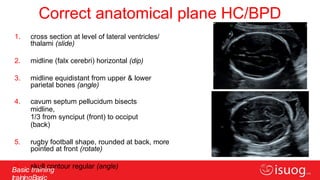 Comprehensive ISUOG Basic Training on Fetal Biometry: Dating, Size ...