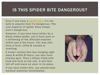 IS THIS SPIDER BITE DANGEROUS?
Even if you have a spider bite , it’s not
safe to assume that it’s dangerous. The
vast majority of spider bites simply
aren’t dangerous.
However, if you have been bitten by a
black widow spider, you’ll have pain or
a stif fening of the af fected muscles
within just a few hour s. You may also
have a fever, chills & nausea or
vomiting.
A brown recluse bite has stinging right
away & within 8 hour s , you may have
intense pain. Then a blister filled with
fluid will form at the site. It will then
fall of f and leave an ulcer in its place .
If you have either bite, you should seek
medical attention immediately.