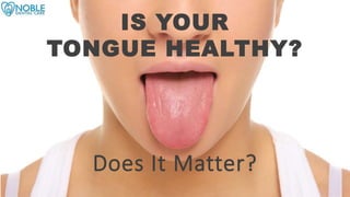 IS YOUR
TONGUE HEALTHY?
Does It Matter?
 