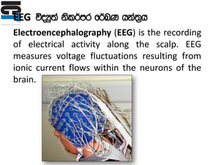 EEG úoHq;a ksl¾mr f¾LK hka;%h
Electroencephalography (EEG) is the recording
of electrical activity along the scalp. EEG
measures voltage fluctuations resulting from
ionic current flows within the neurons of the
brain.
 