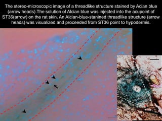 The stereo-microscopic image of a threadlike structure stained by Acian blue
(arrow heads).The solution of Alcian blue was injected into the acupoint of
ST36(arrow) on the rat skin. An Alcian-blue-stanined threadlike structure (arrow
heads) was visualized and proceeded from ST36 point to hypodermis.
 