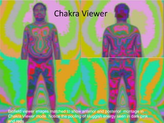Biofield viewer images matched to show anterior and posterior montage in
Chakra Viewer mode. Notice the pooling of sluggish energy seen in dark pink
and reds
Chakra Viewer
 