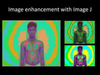 Image enhancement with Image J
 