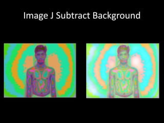 Image J Subtract Background
 