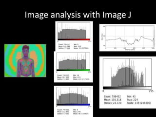 Image analysis with Image J
 