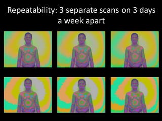 Repeatability: 3 separate scans on 3 days
a week apart
 