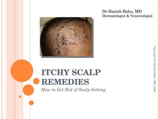 ITCHY SCALP REMEDIES How to Get Rid of Scalp Itching Dr.Hanish Babu, MD Dermatologist & Venereologist Copyright Dr.Hanish Babu, MD; 2009 