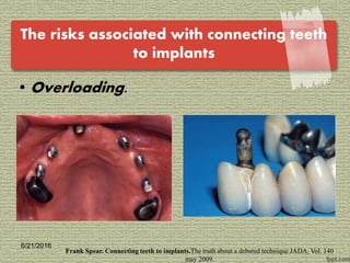 Implant tooth connection | PPTX