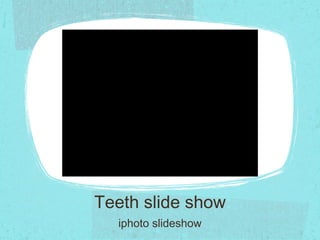 Teeth slide show iphoto slideshow 