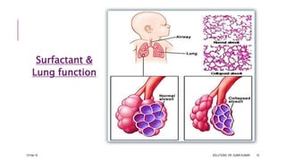 Surfactant &
Lung function
13-Feb-18 SOLUTIONS- DR. SUBIR KUMAR 19
 