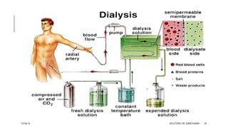 13-Feb-18 SOLUTIONS- DR. SUBIR KUMAR 35
 