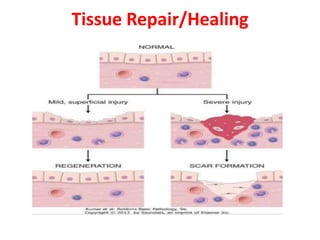 Tissue Repair/Healing
 