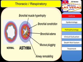 ITE Review

Thoracic / Respiratory

Asthma

Epidemiology

Pathophysiology

Clinical Evaluation
Death Risk Factors
Treatment

 