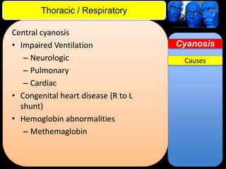ITE Review

Thoracic / Respiratory
Central cyanosis
• Impaired Ventilation
– Neurologic
– Pulmonary
– Cardiac
• Congenital heart disease (R to L
shunt)
• Hemoglobin abnormalities
– Methemaglobin

Cyanosis
Causes

 