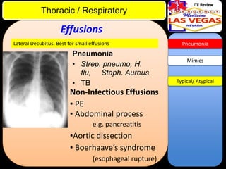 ITE Review

Thoracic / Respiratory

Effusions
Lateral Decubitus: Best for small effusions

Pneumonia
• Strep. pneumo, H.
flu, Staph. Aureus
• TB

Non-Infectious Effusions
• PE
• Abdominal process
e.g. pancreatitis

•Aortic dissection
• Boerhaave’s syndrome
(esophageal rupture)

Pneumonia

Mimics

Typical/ Atypical

 