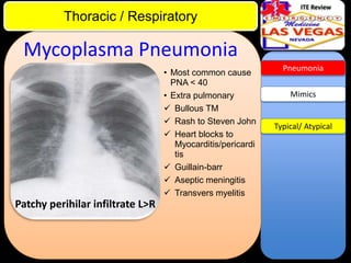 ITE Review

Thoracic / Respiratory

Mycoplasma Pneumonia
• Most common cause
PNA < 40
• Extra pulmonary
 Bullous TM
 Rash to Steven John
 Heart blocks to
Myocarditis/pericardi
tis
 Guillain-barr
 Aseptic meningitis
 Transvers myelitis

Patchy perihilar infiltrate L>R

Pneumonia

Mimics

Typical/ Atypical

 