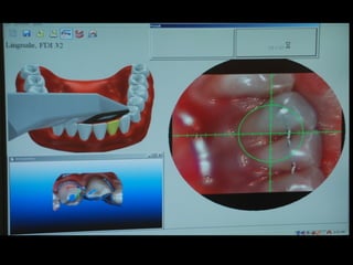 Projecting an array of lines 
 