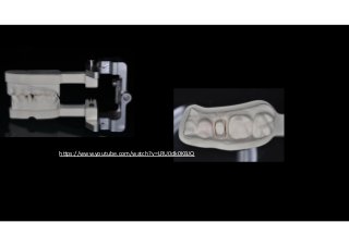 hlps://www.youtube.com/watch?v=LRU0dk0KBJQ 
 