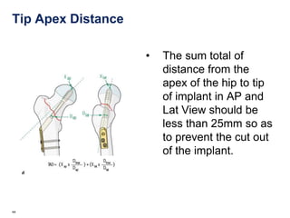 Fracture IT Femur | PPTX