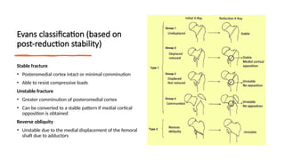 IT fracture.pptx inter trochenteric fractures. | PPTX