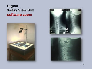 38
Digital
X-Ray View Box
software zoom
 