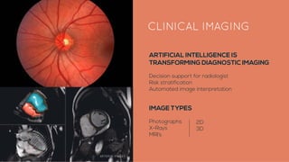 ARTERYS IMAGES
ARTIFICIAL INTELLIGENCE IS
TRANSFORMING DIAGNOSTIC IMAGING
Decision support for radiologist
Risk stratifica...