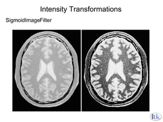 Intensity Transformations SigmoidImageFilter 