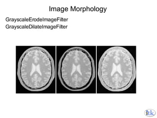 Image Morphology GrayscaleErodeImageFilter GrayscaleDilateImageFilter 