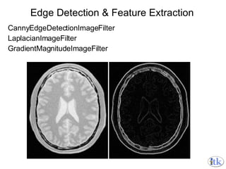 Edge Detection & Feature Extraction CannyEdgeDetectionImageFilter LaplacianImageFilter GradientMagnitudeImageFilter 
