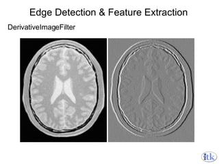 Edge Detection & Feature Extraction DerivativeImageFilter 