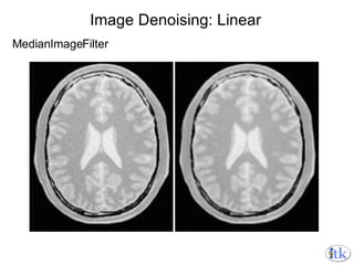 Image Denoising: Linear MedianImageFilter 