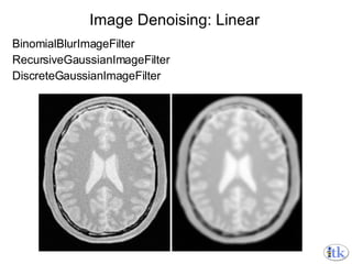 Image Denoising: Linear BinomialBlurImageFilter RecursiveGaussianImageFilter DiscreteGaussianImageFilter 