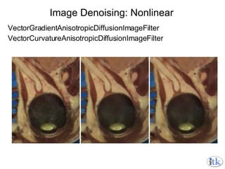 Image Denoising: Nonlinear VectorGradientAnisotropicDiffusionImageFilter VectorCurvatureAnisotropicDiffusionImageFilter 